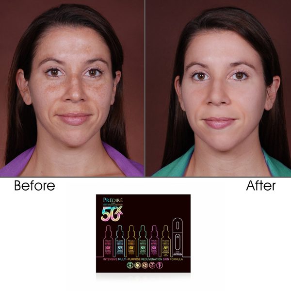 50X Intensive Multi-Purpose Rejuvenation Skin Diffusion Collection - Image 4