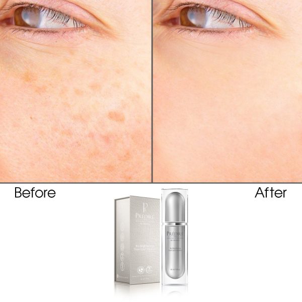 Bio Brightening Dark Spot Solution (Rich with Vitamin E & A), 30ml - Image 2