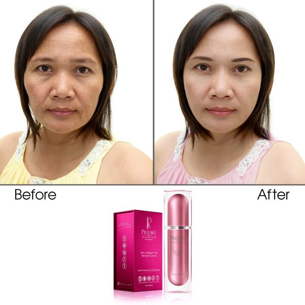Skin Collagen Cell Renewal Cream (Treats Wrinkles & Age-Defying) - Image 2