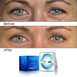 Intensive Rapid Renewal Eye Care Anti Aging Gel (Treats Puffiness and Dark Circles)