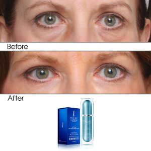 Apple & Grape Stem Cell Intensive Rapid Renewal Eye Care Anti Aging Night Serum (Treats Puffiness and Dark Circles)