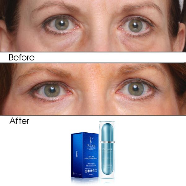 Apple & Grape Stem Cell Intensive Rapid Renewal Eye Care Anti Aging Night Serum (Treats Puffiness and Dark Circles) - Image 2