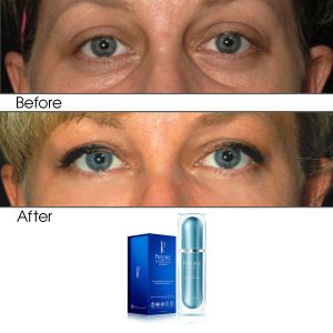 Intensive Rapid Renewal Eye Care Anti Aging Day Serum (Treats Puffiness and Dark Circles)