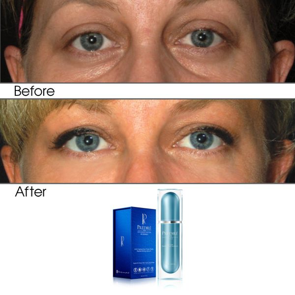 Intensive Rapid Renewal Eye Care Anti Aging Day Serum (Treats Puffiness and Dark Circles) - Image 2