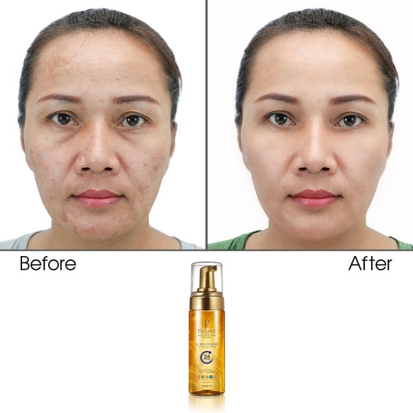 Hydrating Lava Foam Facial Cleanser (Rich with Vitamin E & A) - Image 2