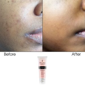 Triple Acting Facial Cleansing Scrub Powered by Bio Organica Collagen Technology