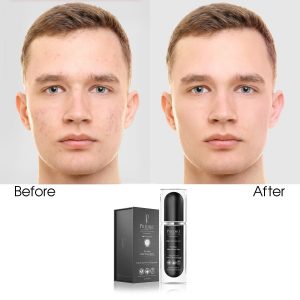 For Men After Shave Balm (Infused)
