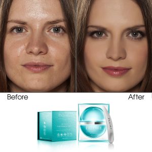 Oil Control Daily Moisturizer Cream (Rich with Vitamin E)