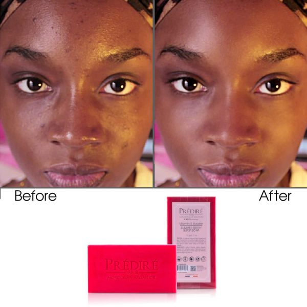 Summer Berry Soap 175G - (Infused) - Image 5
