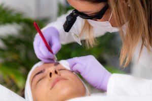 Read more about the article Top Benefits of Microneedling: Achieve Flawless Skin